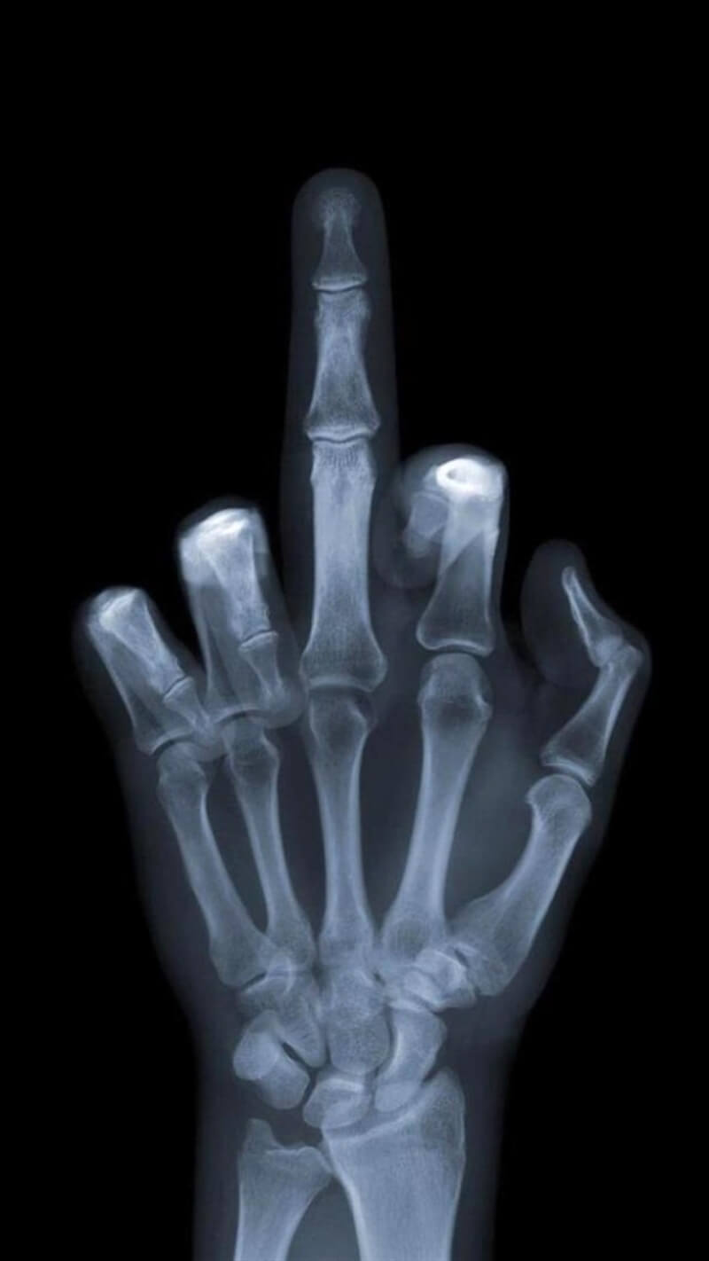 fond d'écran smartphone rayon X signe de la main doigt wallpaper