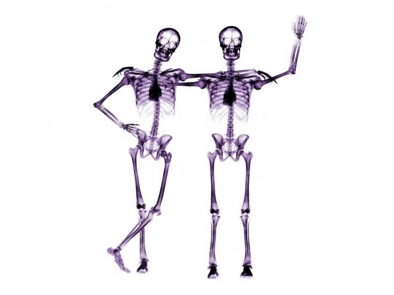 fond d'écran hd humour funny squelette amis scan radio image photo radio